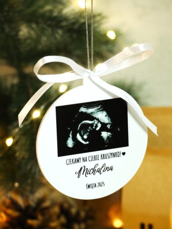 Bombka ze zdjęciem USG