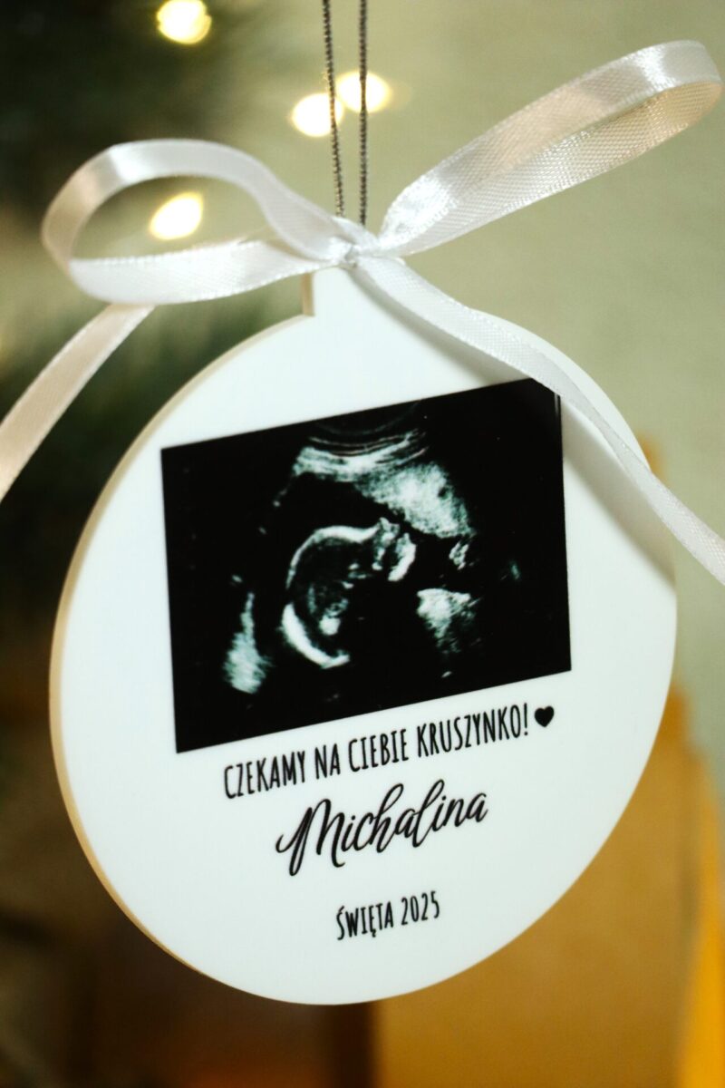 Bombka ze zdjęciem USG