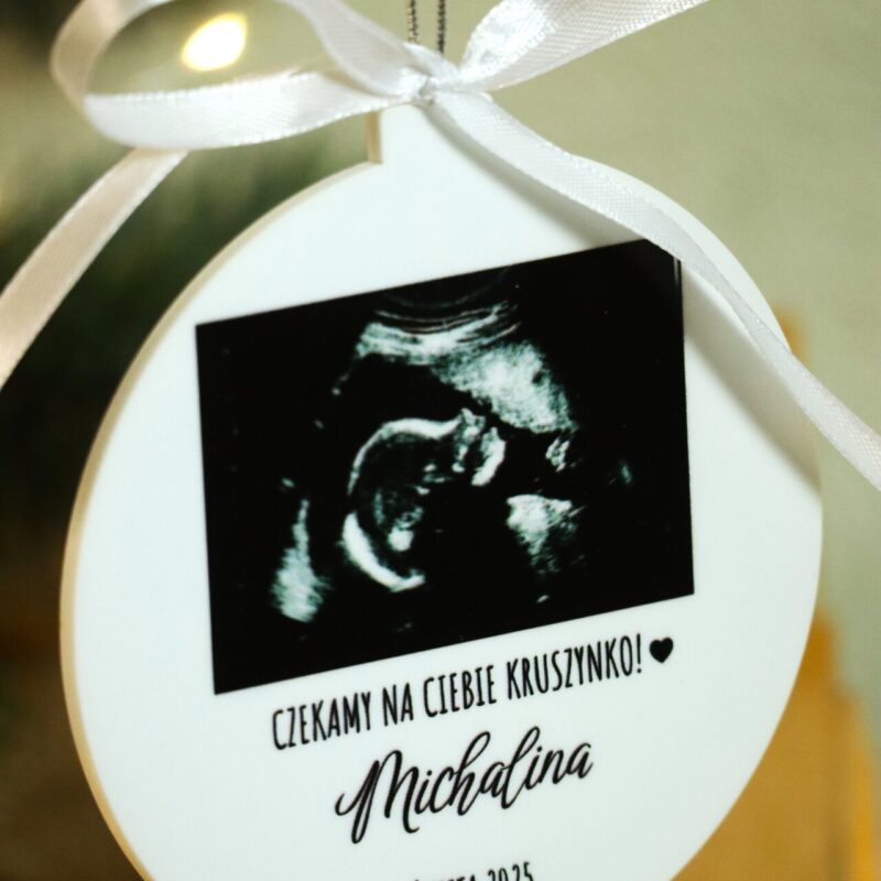 Bombka ze zdjęciem USG