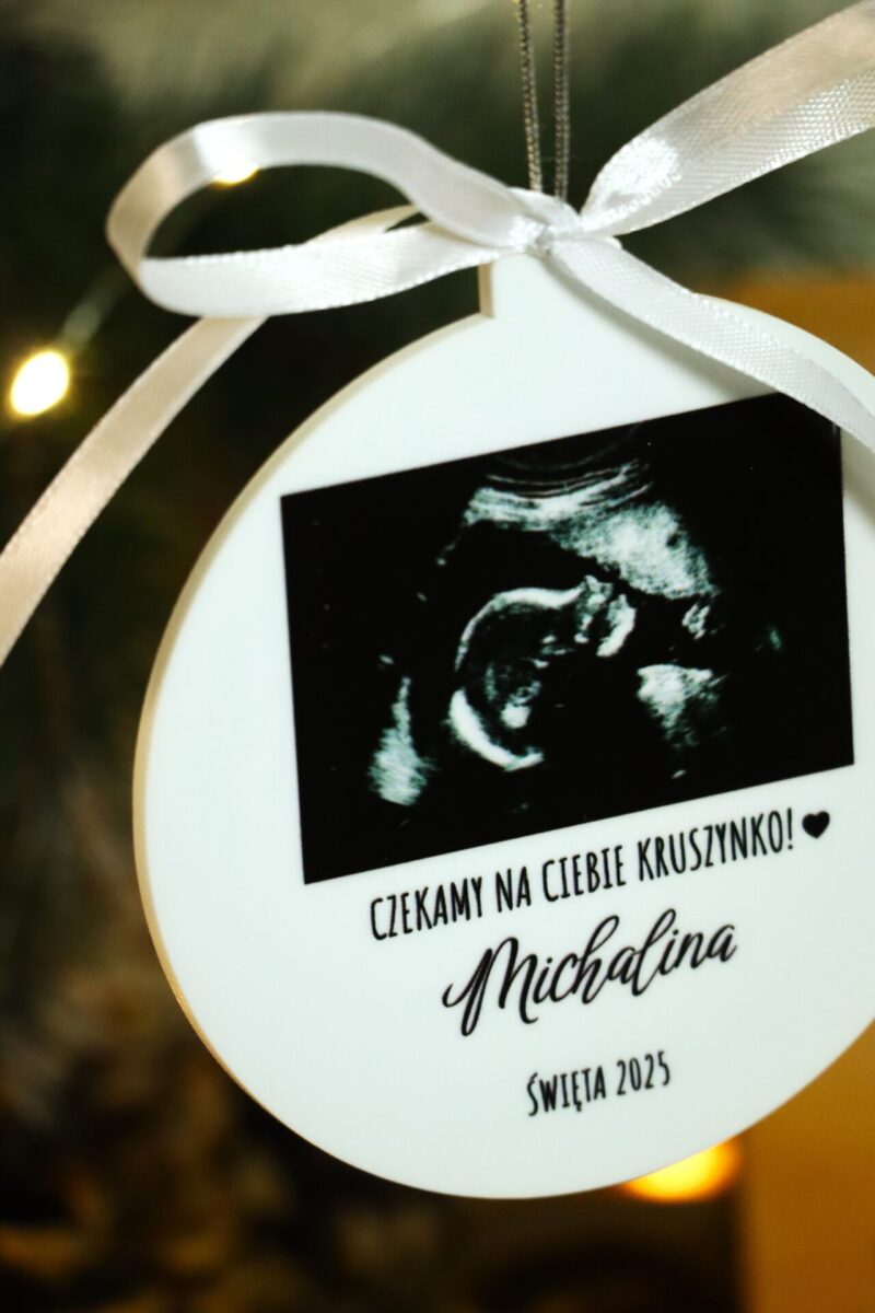 Bombka ze zdjęciem USG