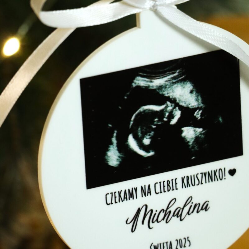 Bombka ze zdjęciem USG