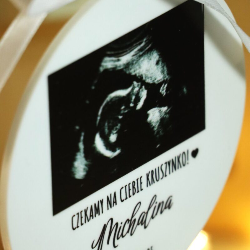 Bombka ze zdjęciem USG